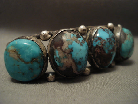 Amazing Vintage Navajo 'Bulbous Turquoise' Bisbee Silver Bracelet