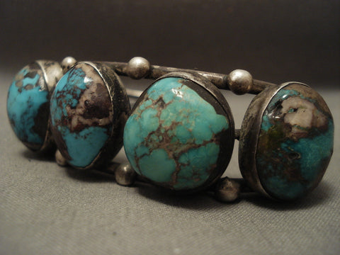 Amazing Vintage Navajo 'Bulbous Turquoise' Bisbee Silver Bracelet